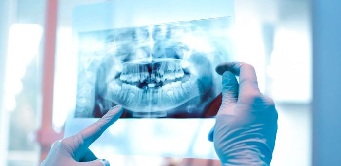 cirugia-maxilofacial-que-es